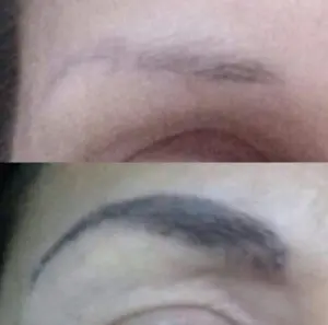 Eliminación cejas micropigmentación